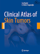 Clinical Atlas of Skin Tumors2014